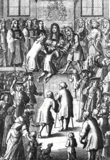 Divine Right of Kings King-Charles-II-scrofula (wikimedia commons